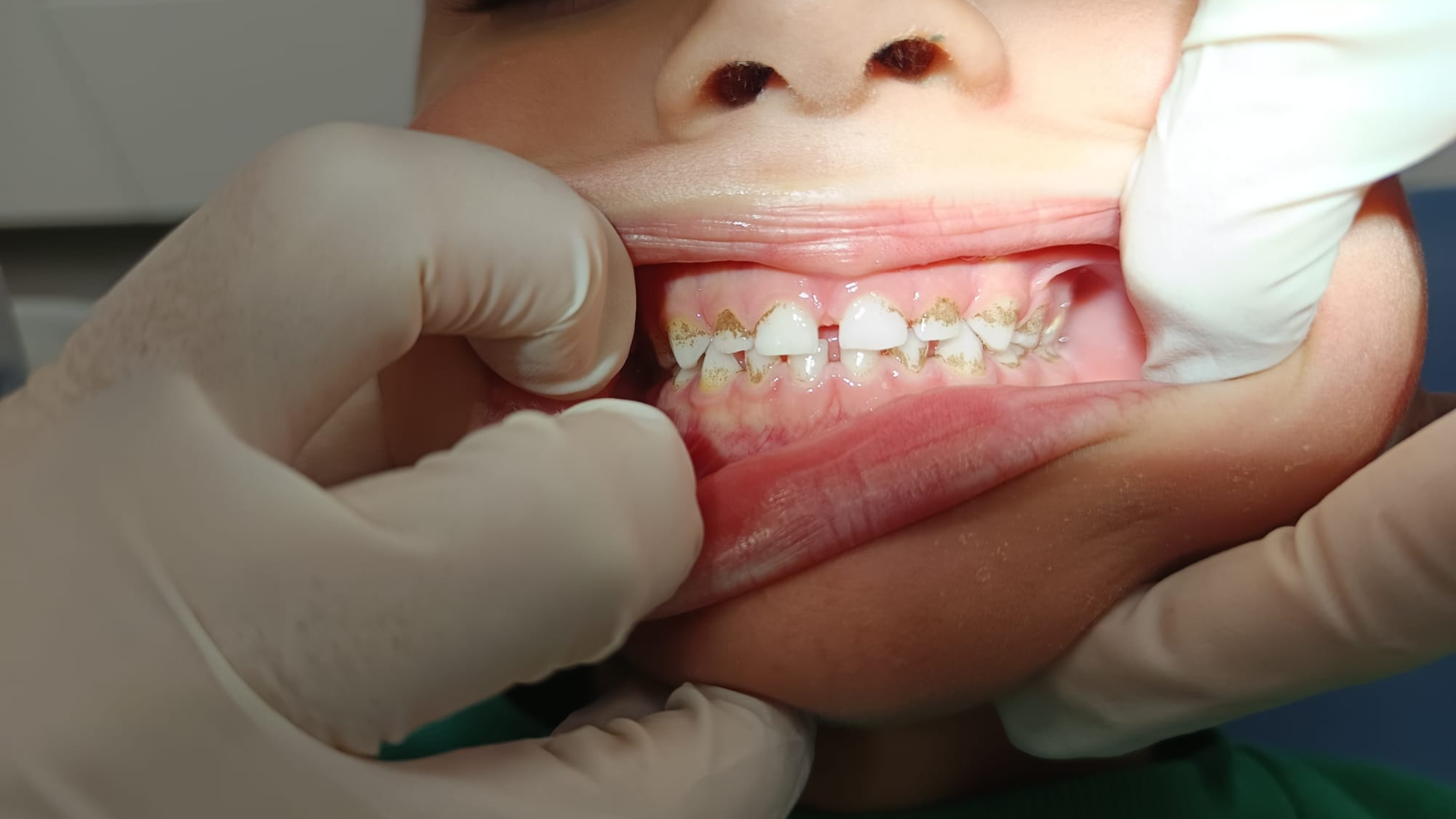 dentistas niños en sevilla