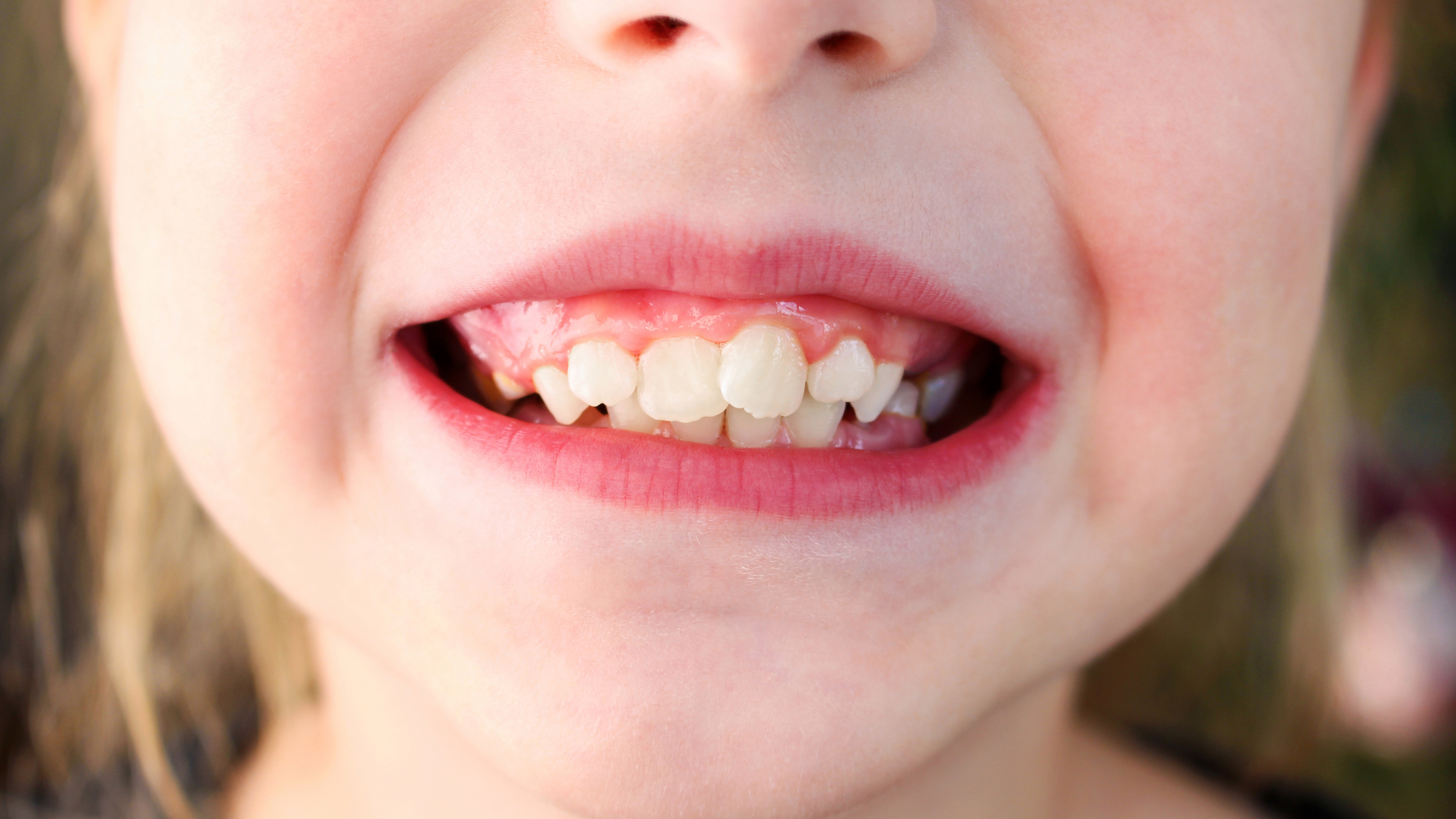 dentistas niños en sevilla